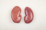 Riñones De Cerdo - Imagen 2
